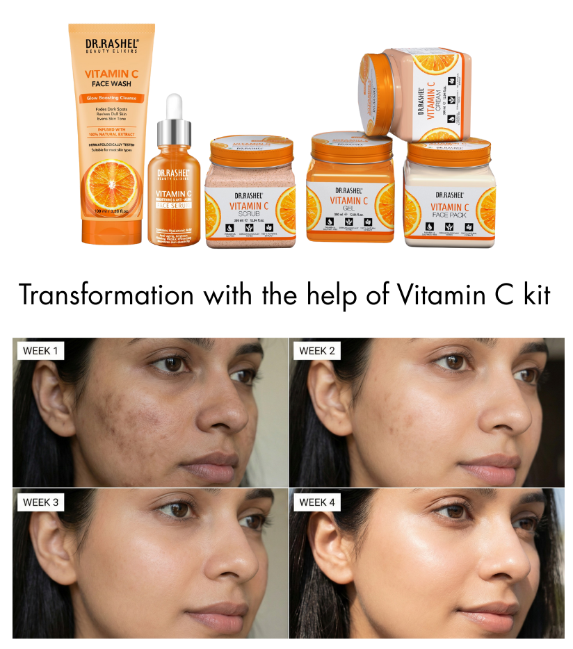 Vitamin C kits results in 4 weeks